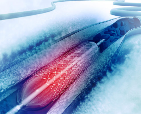 Medical Image Medical Image